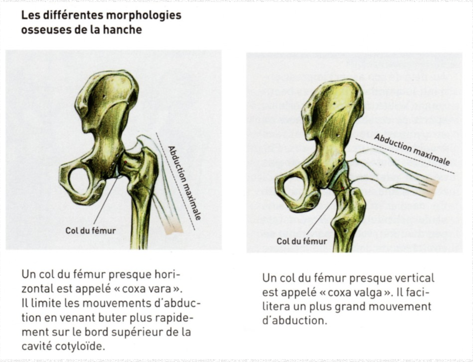 Différents cols du fémur